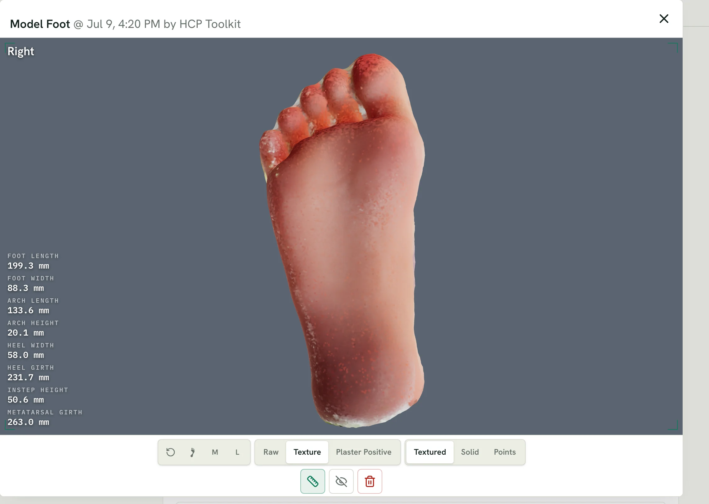 Connect scan viewer showing a textured 3D foot scan with nine measurements, from foot length to metatarsal girth